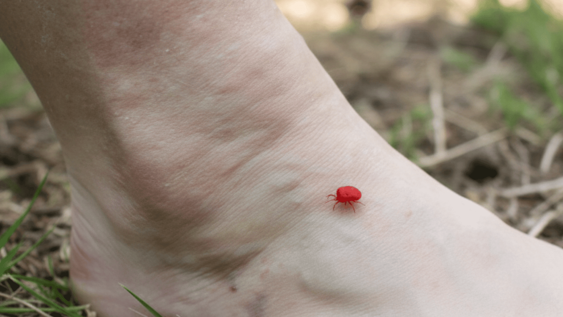 how to get rid of chiggers in yard